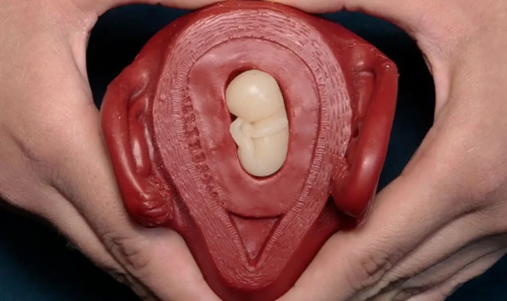 10 Weeks Pregnant Ultrasound